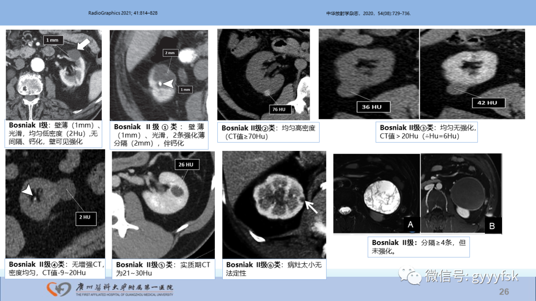 【PPT】肾癌相关影像诊断的文献汇报-26