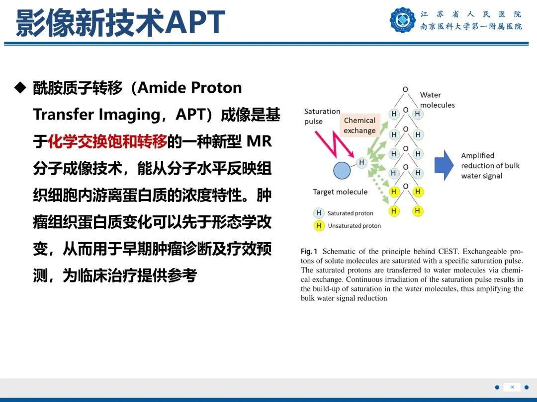 【PPT】输卵管结核-31