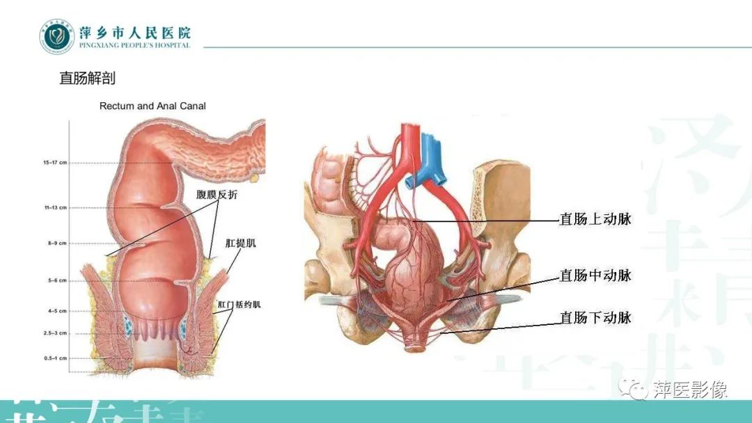 【PPT】直肠癌MR分期-2