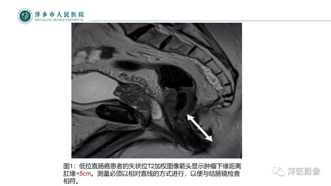 【PPT】直肠癌MR分期-27