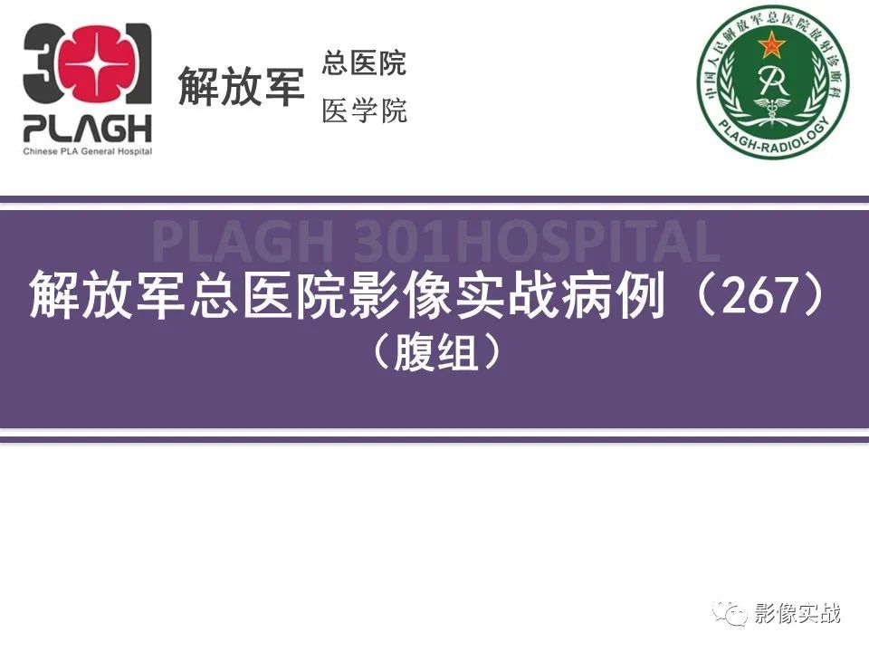 【病例】小肠间质瘤1例CT影像-1