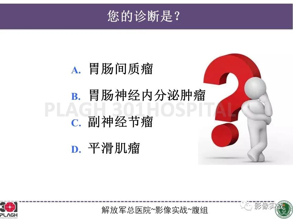 【病例】小肠间质瘤1例CT影像-10
