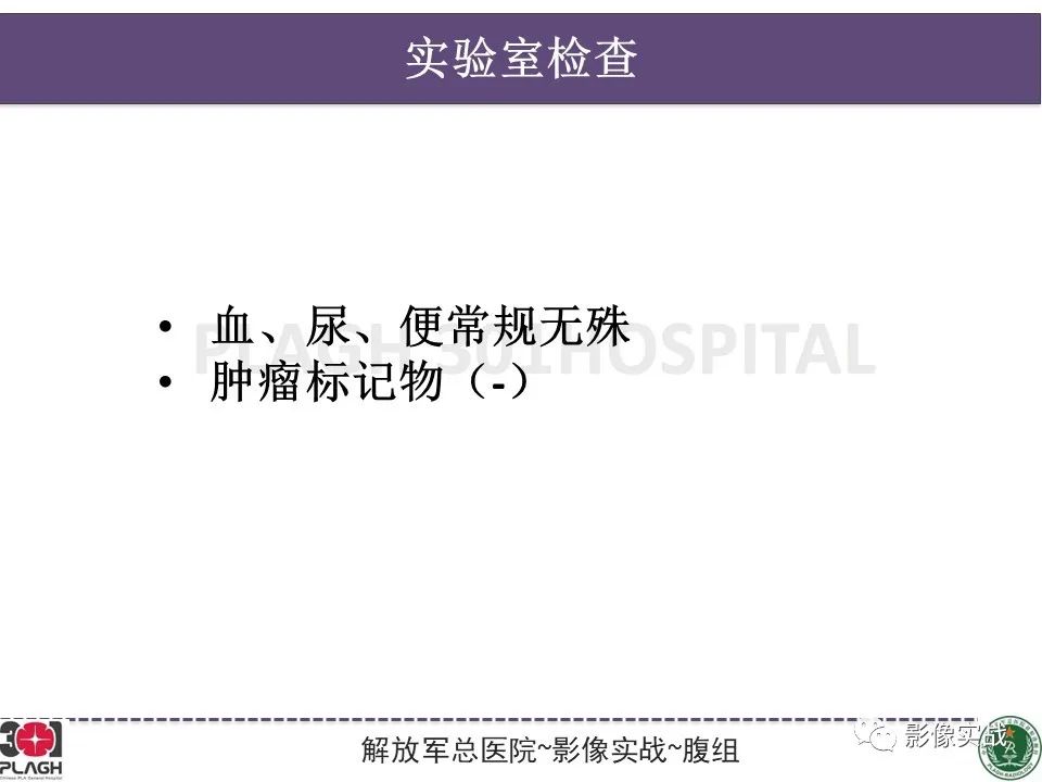 【病例】小肠间质瘤1例CT影像-3