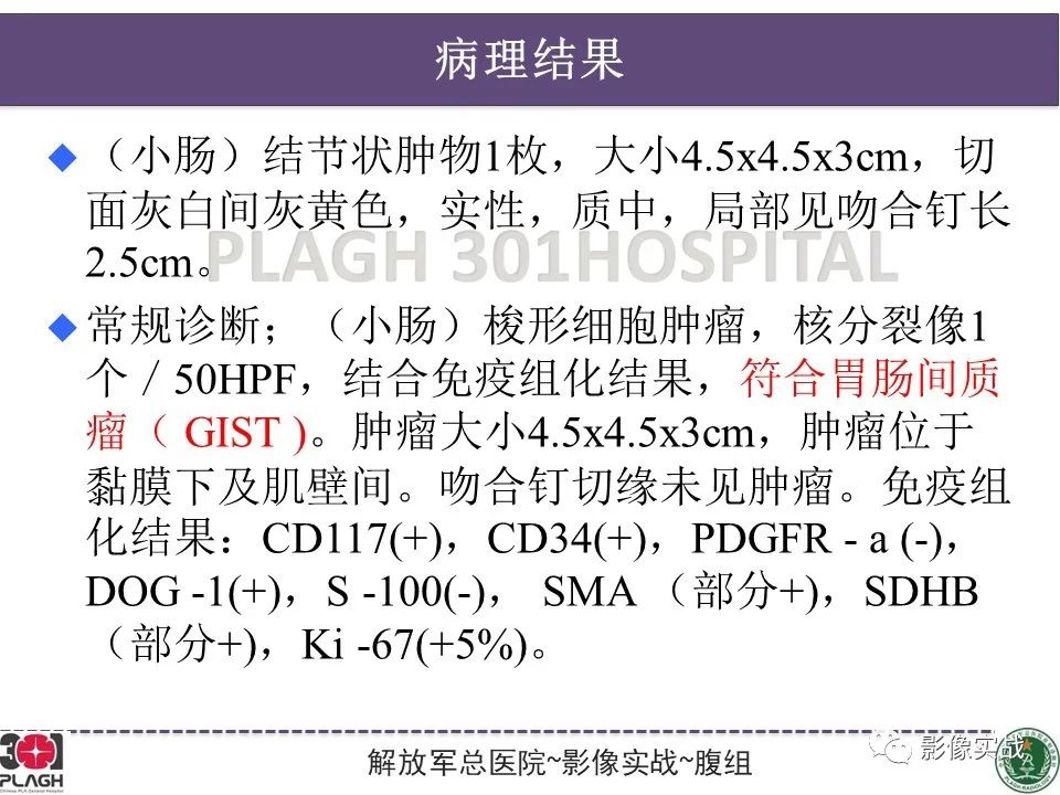 【病例】小肠间质瘤1例CT影像-18