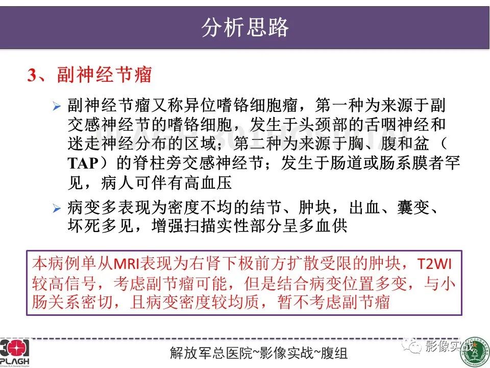 【病例】小肠间质瘤1例CT影像-15