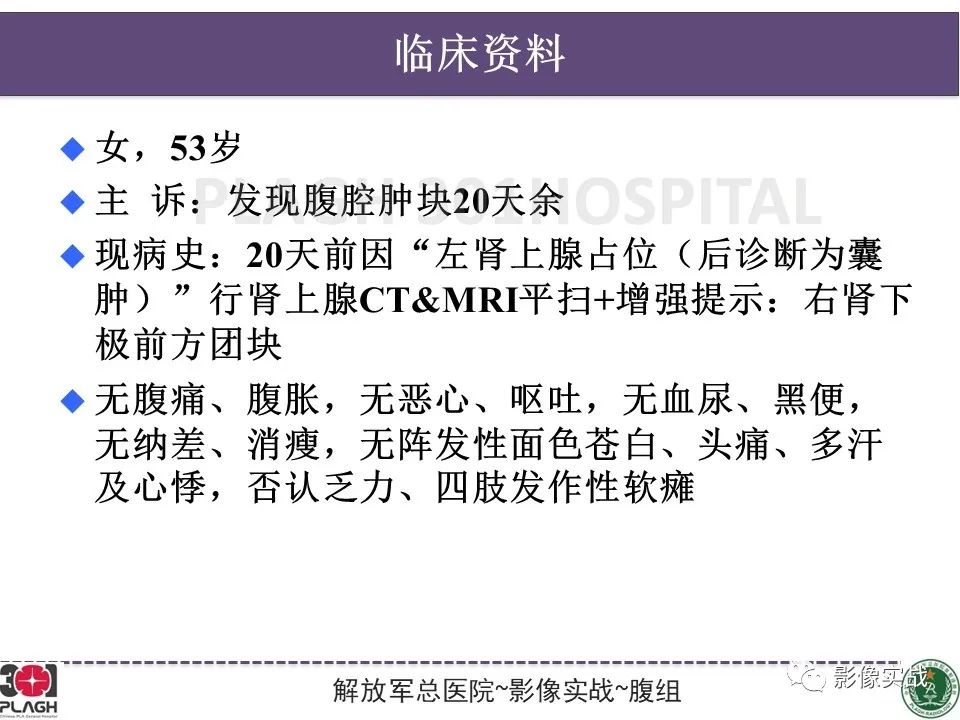 【病例】小肠间质瘤1例CT影像-2