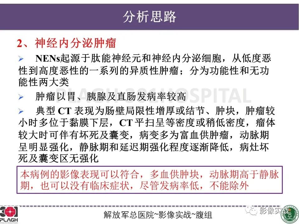 【病例】小肠间质瘤1例CT影像-14