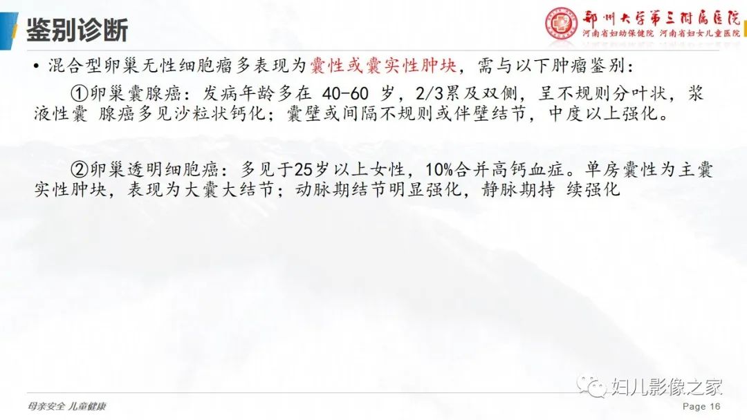 【病例】卵巢无性细胞瘤1例CT及MR影像-16