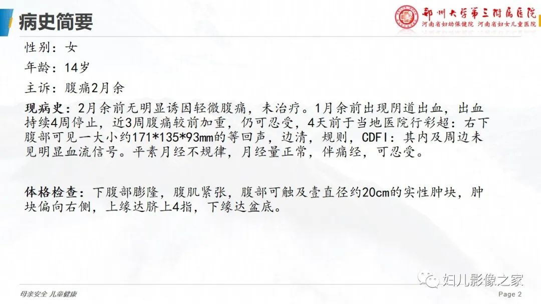 【病例】卵巢无性细胞瘤1例CT及MR影像-2