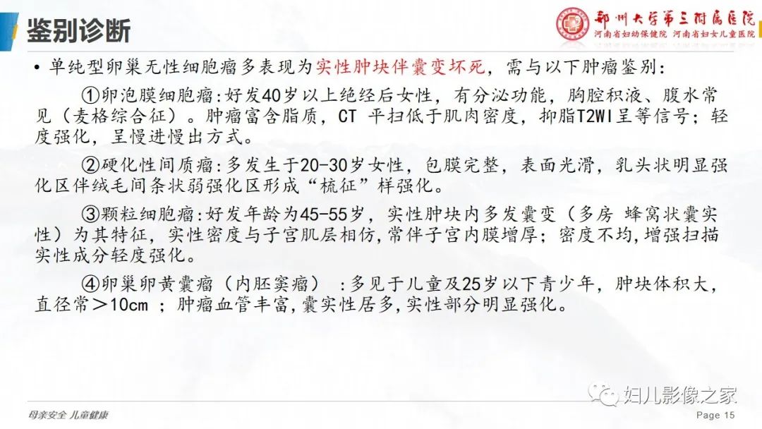 【病例】卵巢无性细胞瘤1例CT及MR影像-15