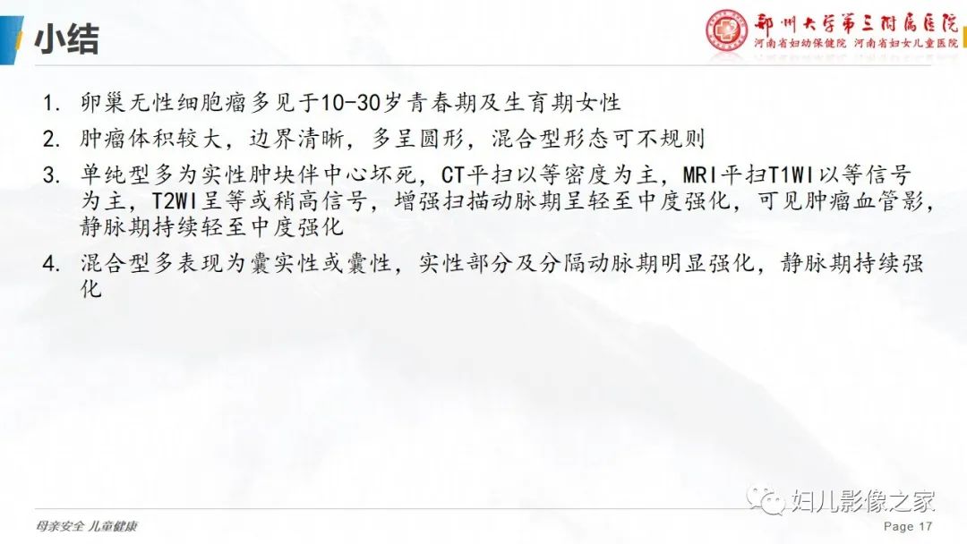 【病例】卵巢无性细胞瘤1例CT及MR影像-17