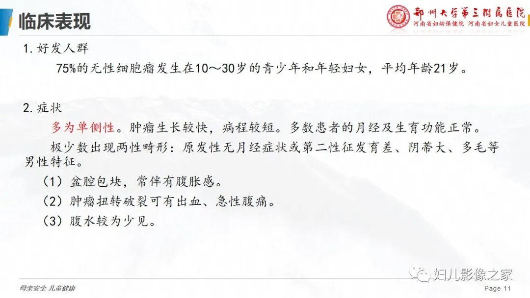 【病例】卵巢无性细胞瘤1例CT及MR影像-11