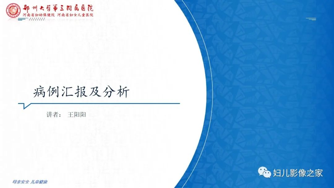 【病例】卵巢无性细胞瘤1例CT及MR影像-1