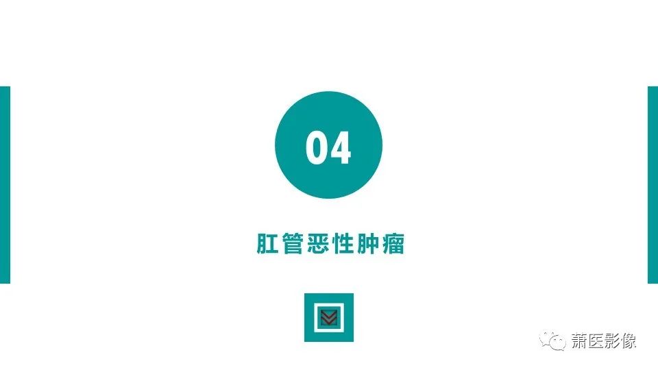 【PPT】肛管及肛周区域病变MRI影像特征-33