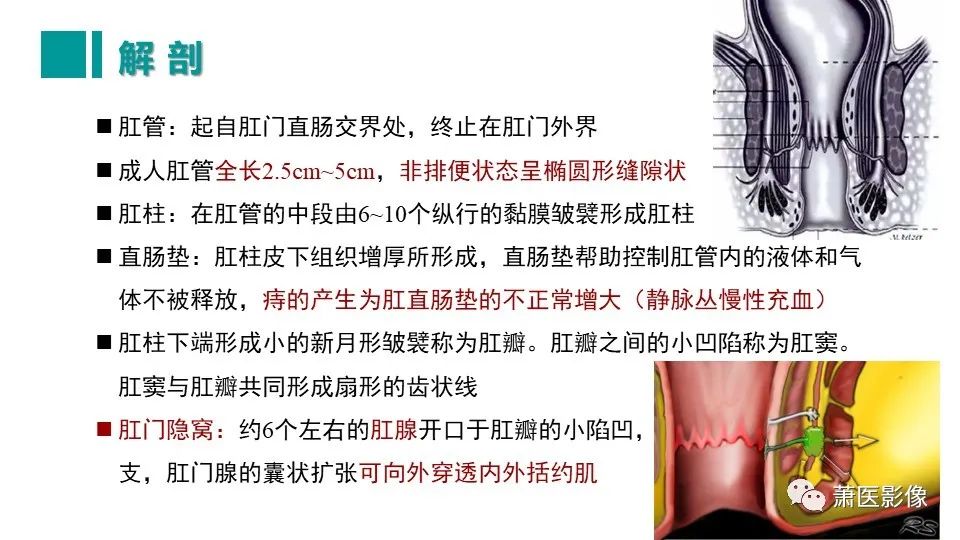 【PPT】肛管及肛周区域病变MRI影像特征-9
