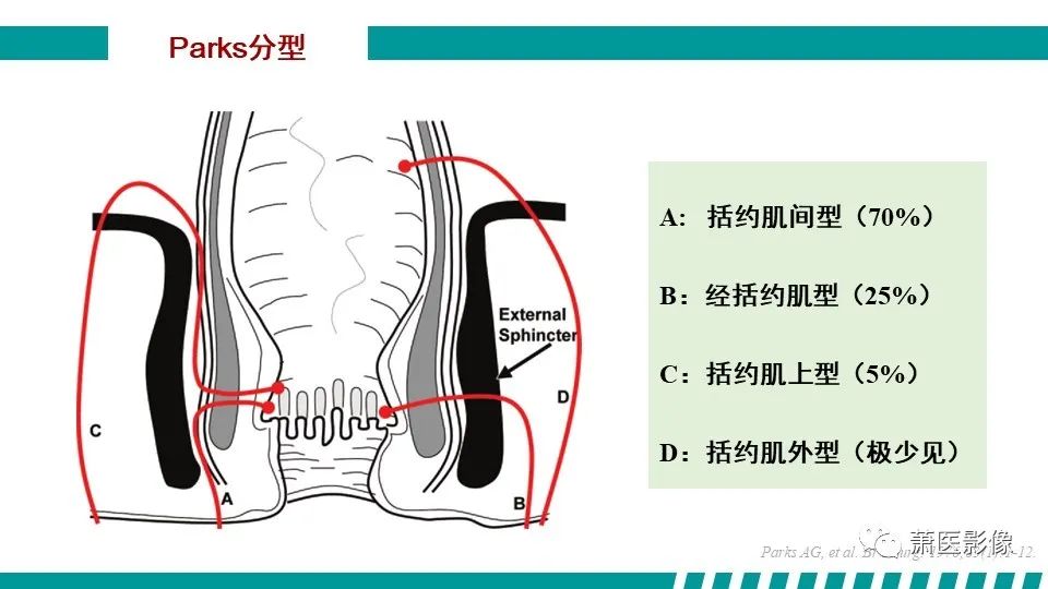 【PPT】肛管及肛周区域病变MRI影像特征-23