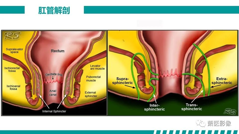 【PPT】肛管及肛周区域病变MRI影像特征-10
