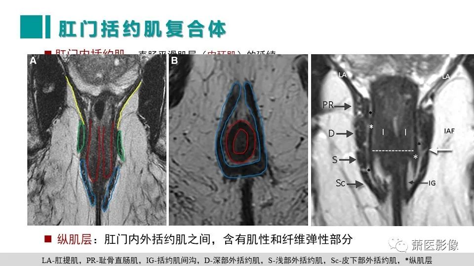 【PPT】肛管及肛周区域病变MRI影像特征-12