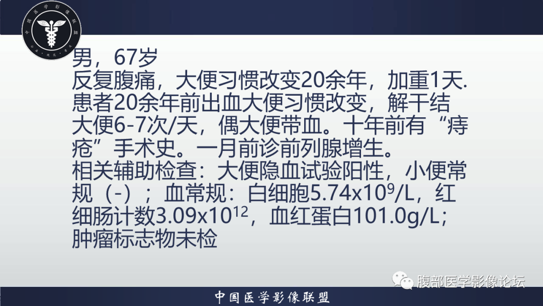 【病例】直肠血管瘤1例CT及MR-2