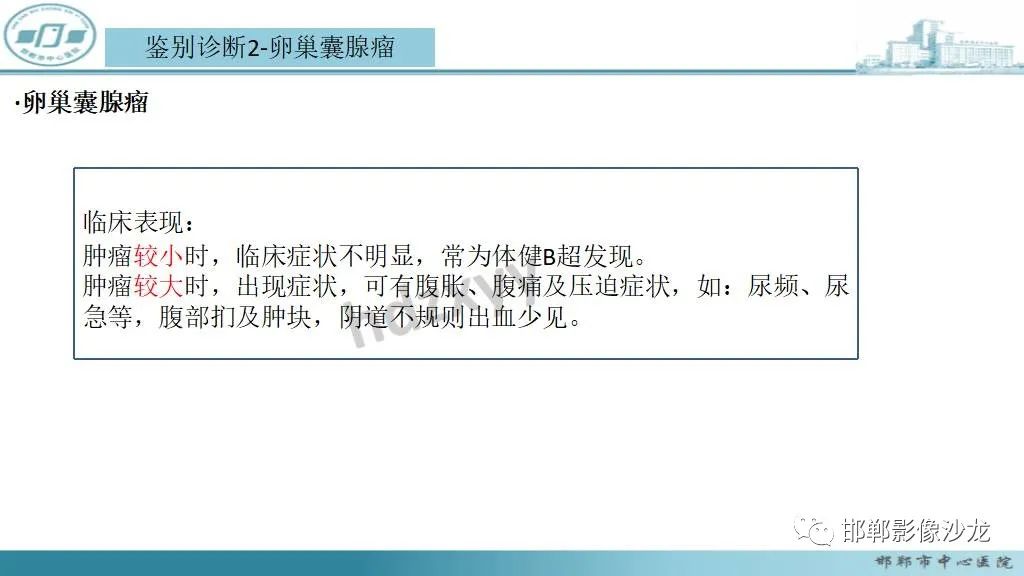 【病例】卵巢甲状腺肿1例CT影像-23