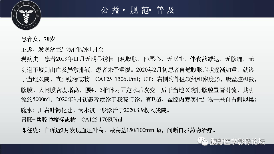 【病例】卵巢甲状腺肿1例CT影像-3