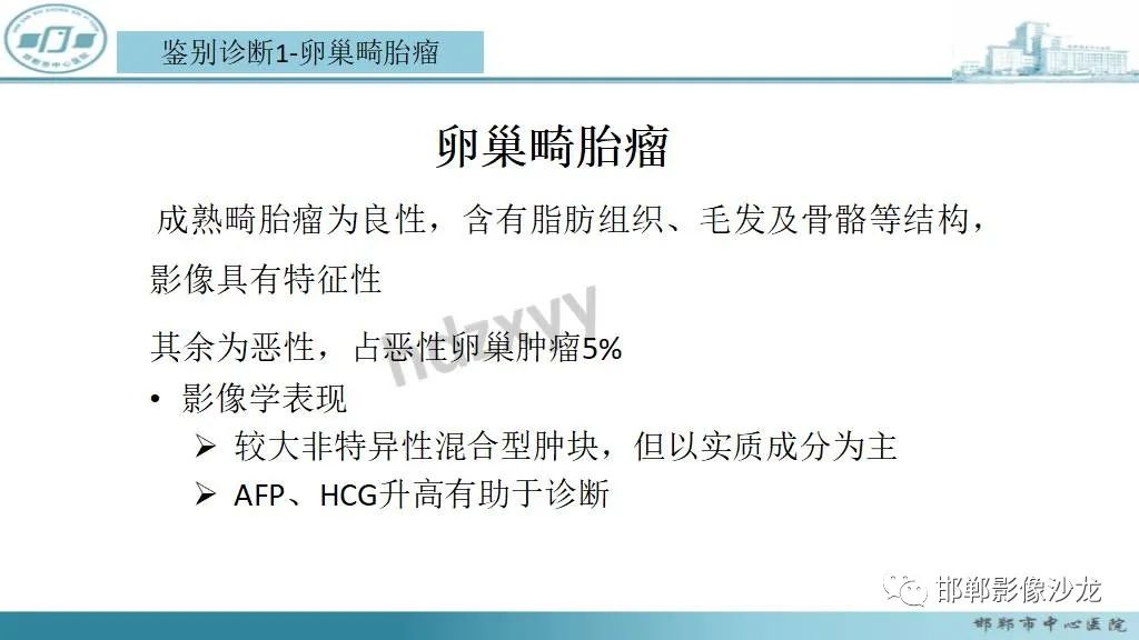 【病例】卵巢甲状腺肿1例CT影像-20