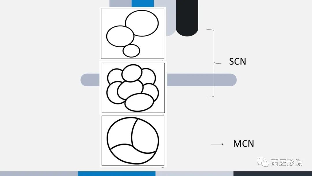 【PPT】常见胰腺囊性肿瘤-11
