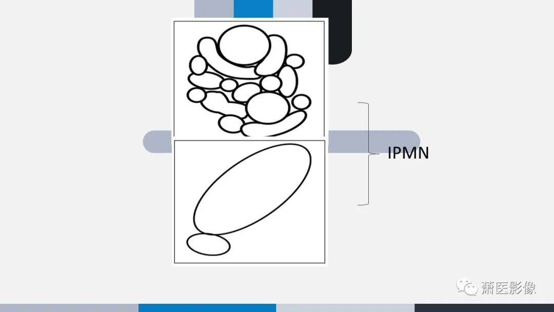 【PPT】常见胰腺囊性肿瘤-24