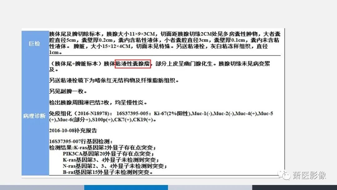 【PPT】常见胰腺囊性肿瘤-49