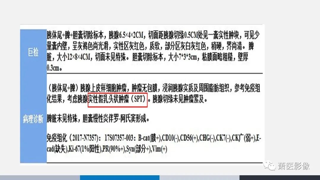 【PPT】常见胰腺囊性肿瘤-55