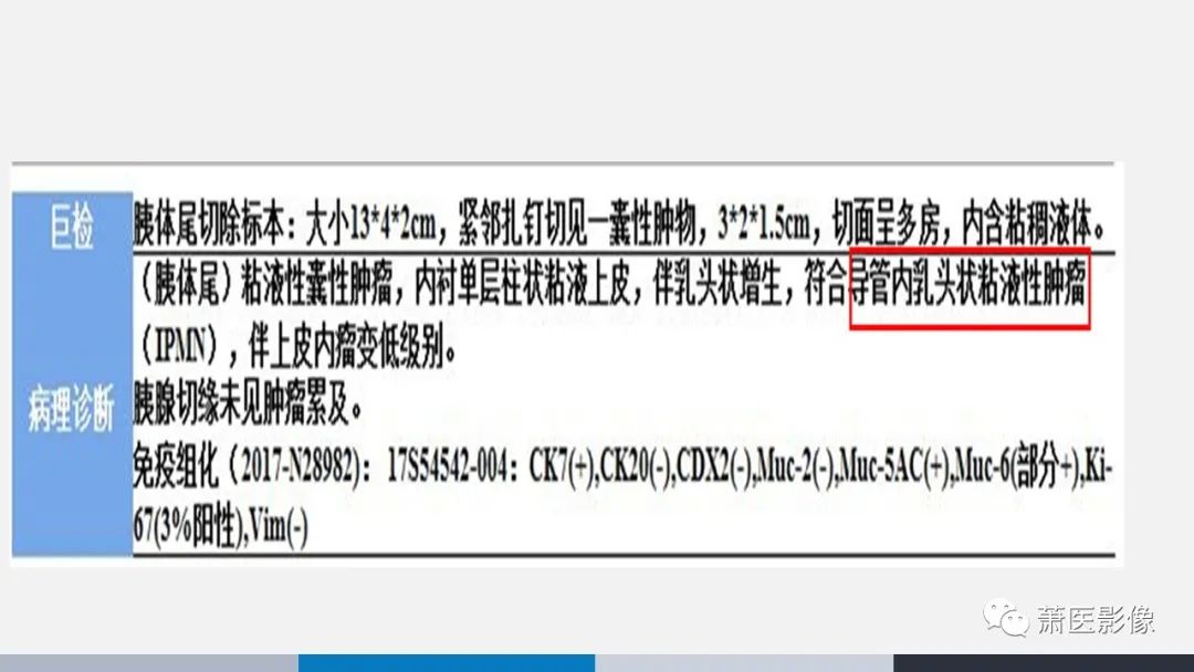 【PPT】常见胰腺囊性肿瘤-52