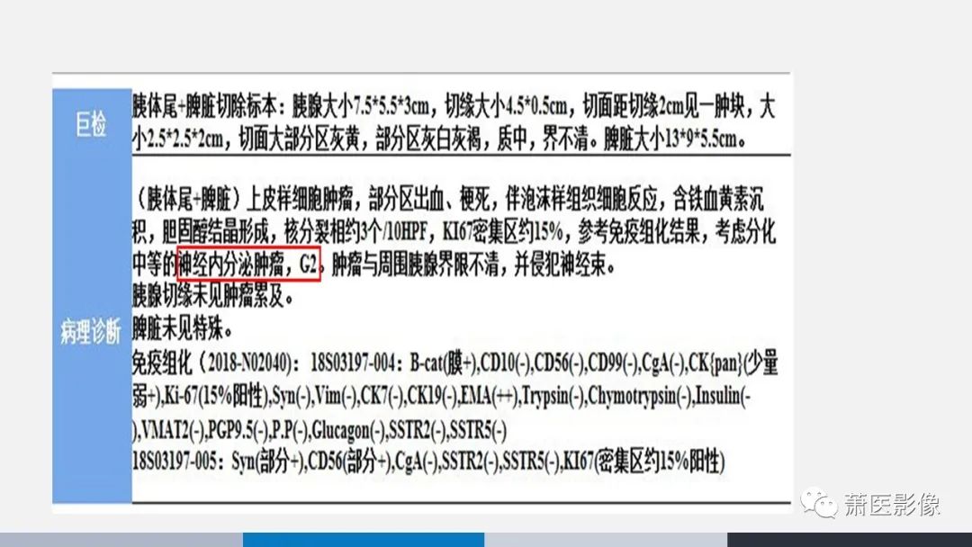 【PPT】常见胰腺囊性肿瘤-57