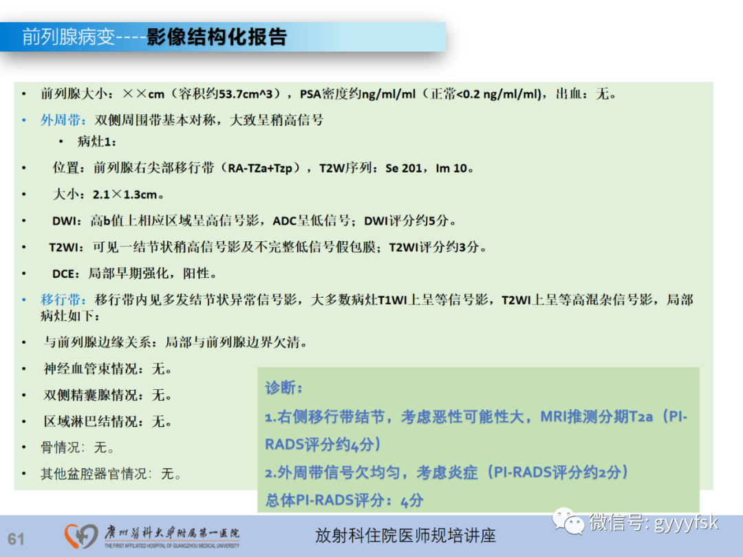 【PPT】前列腺癌的MR扫描规范及精准诊断-62