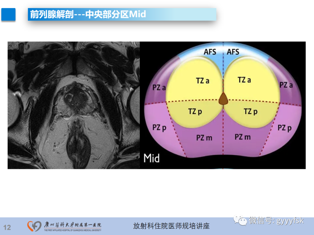 【PPT】前列腺癌的MR扫描规范及精准诊断-13