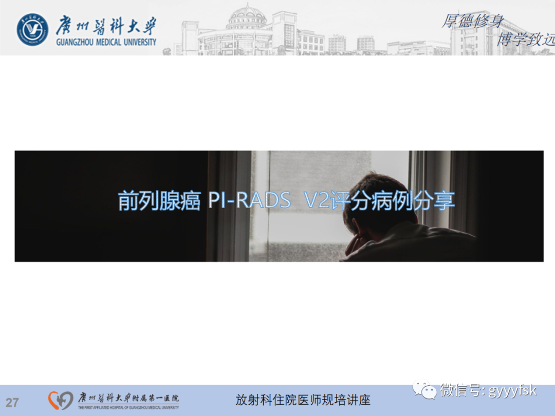 【PPT】前列腺癌的MR扫描规范及精准诊断-28