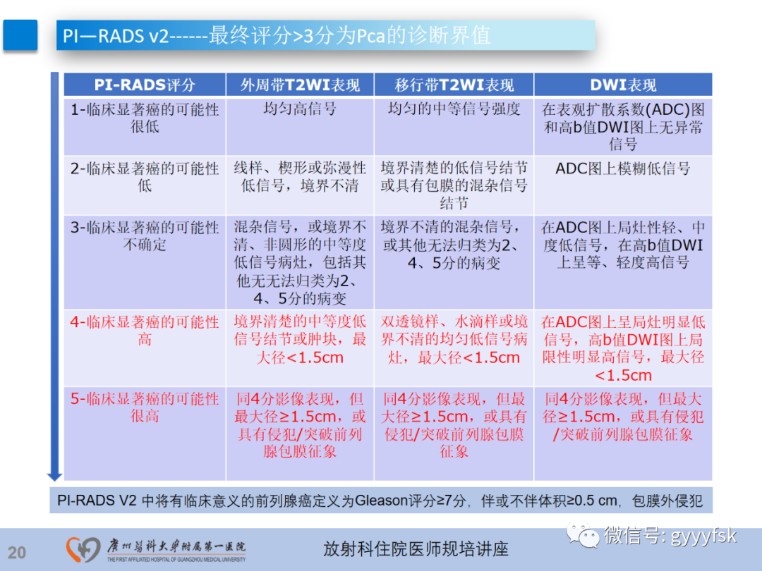 【PPT】前列腺癌的MR扫描规范及精准诊断-21
