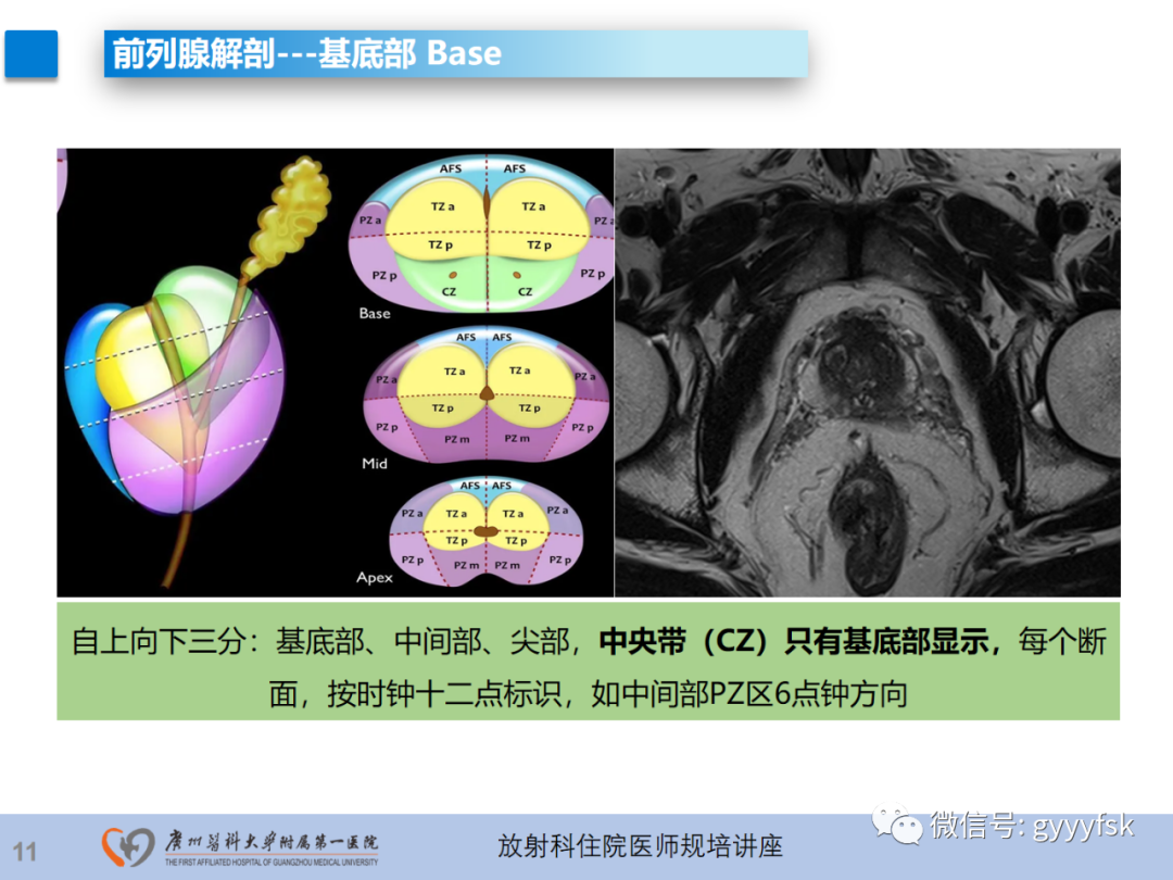 【PPT】前列腺癌的MR扫描规范及精准诊断-12