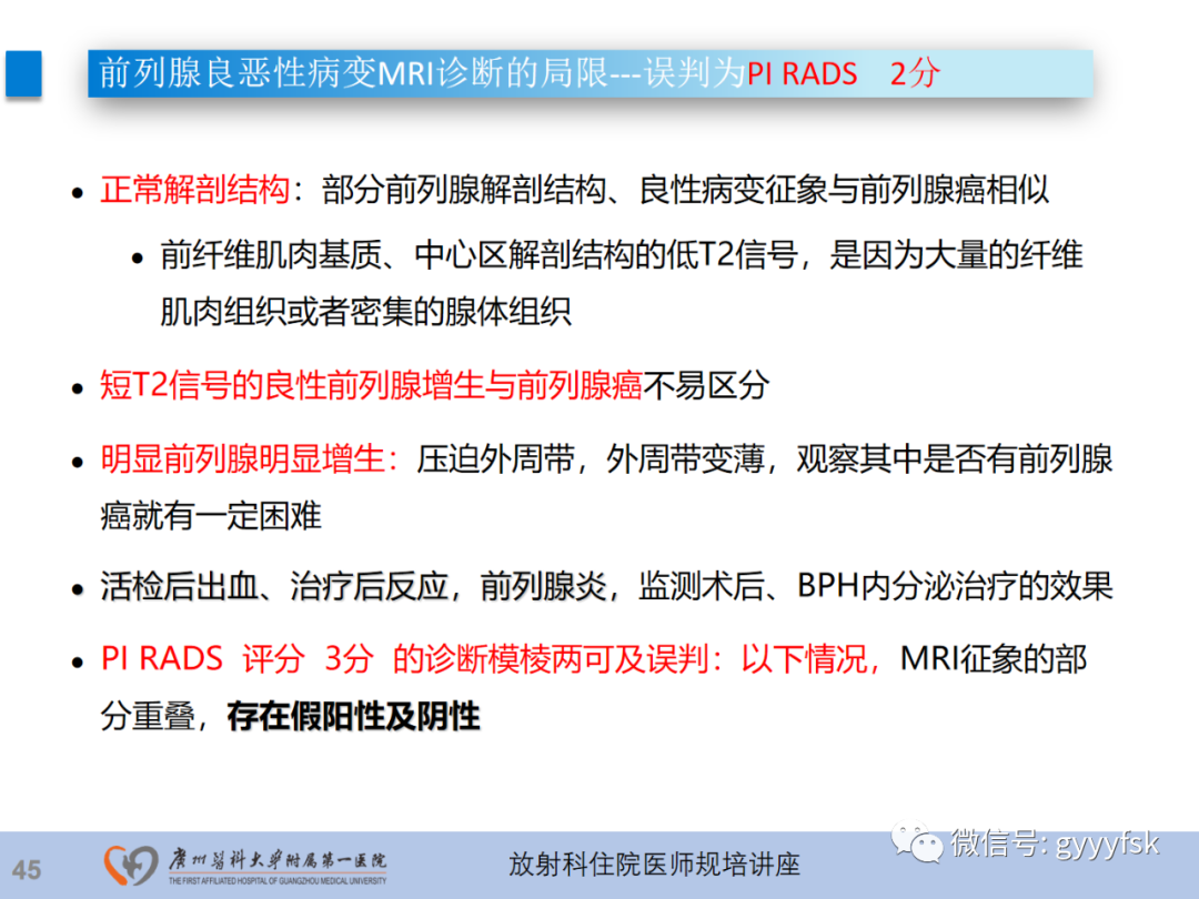【PPT】前列腺癌的MR扫描规范及精准诊断-46
