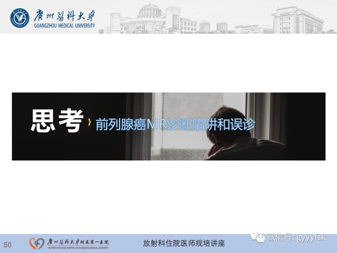 【PPT】前列腺癌的MR扫描规范及精准诊断-51