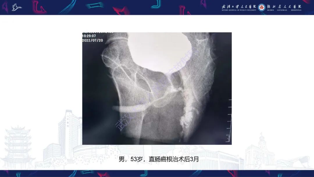 【PPT】尿道造影疾病诊断-41