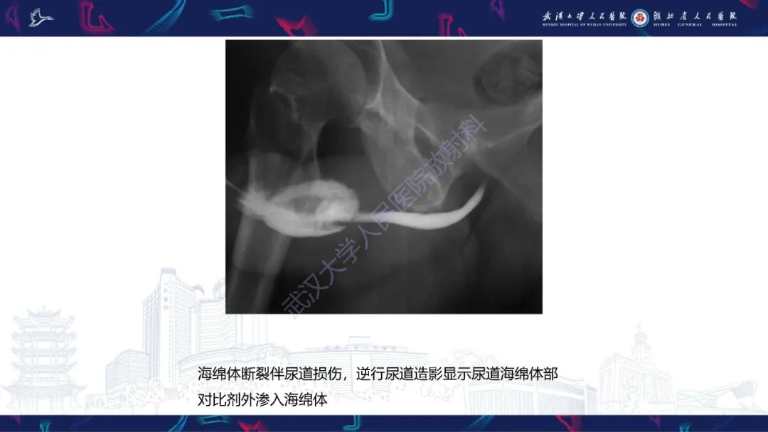 【PPT】尿道造影疾病诊断-37