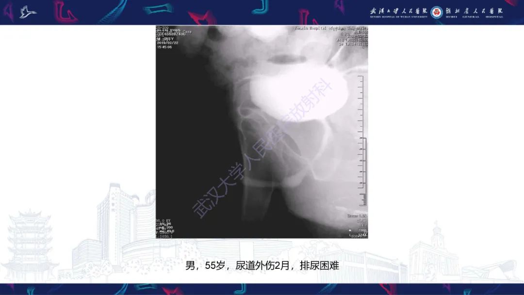 【PPT】尿道造影疾病诊断-26