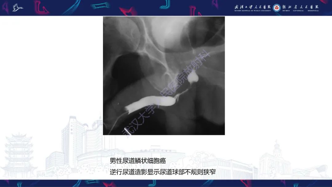 【PPT】尿道造影疾病诊断-53