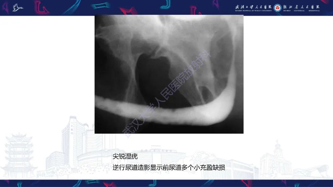 【PPT】尿道造影疾病诊断-48