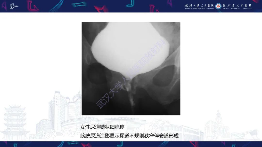 【PPT】尿道造影疾病诊断-57