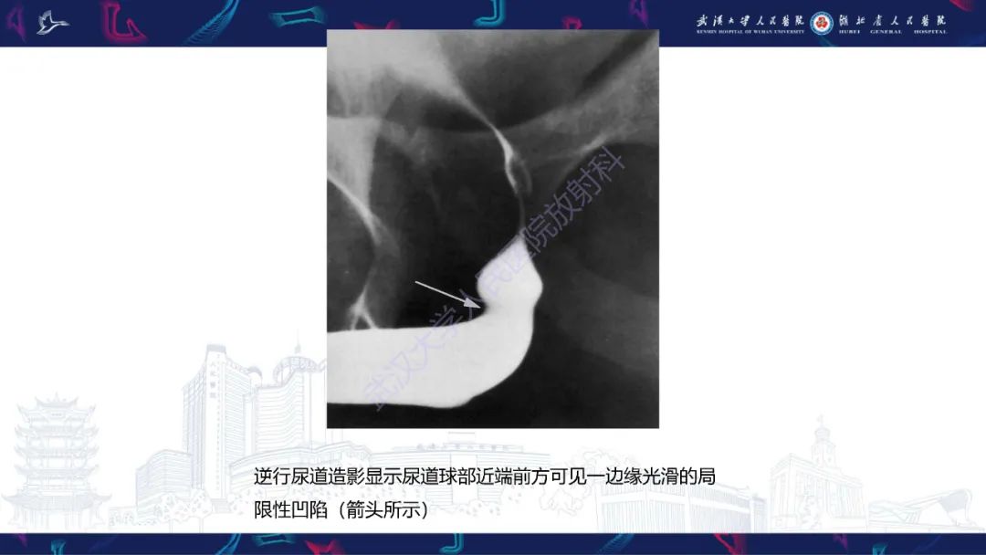 【PPT】尿道造影疾病诊断-11