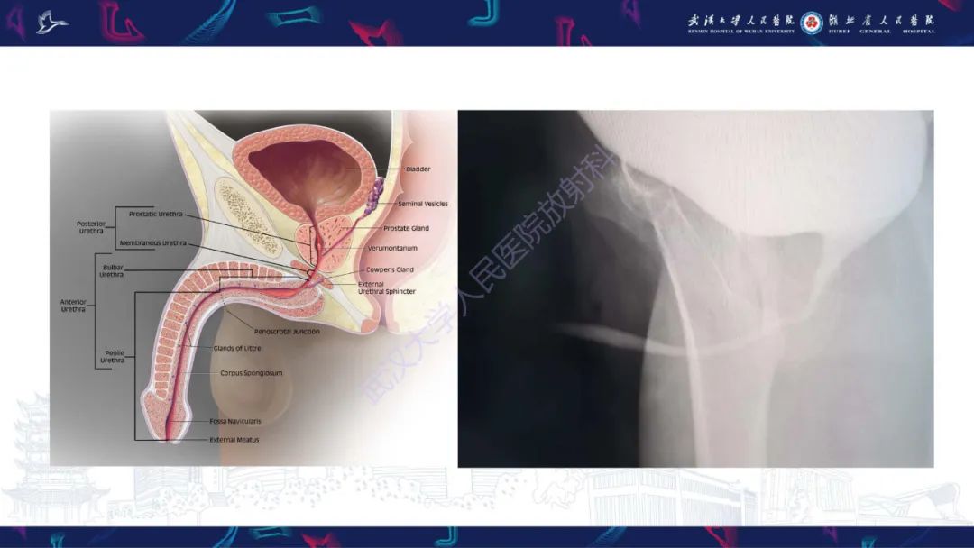 【PPT】尿道造影疾病诊断-3