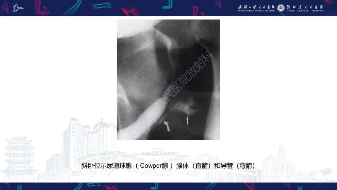 【PPT】尿道造影疾病诊断-14