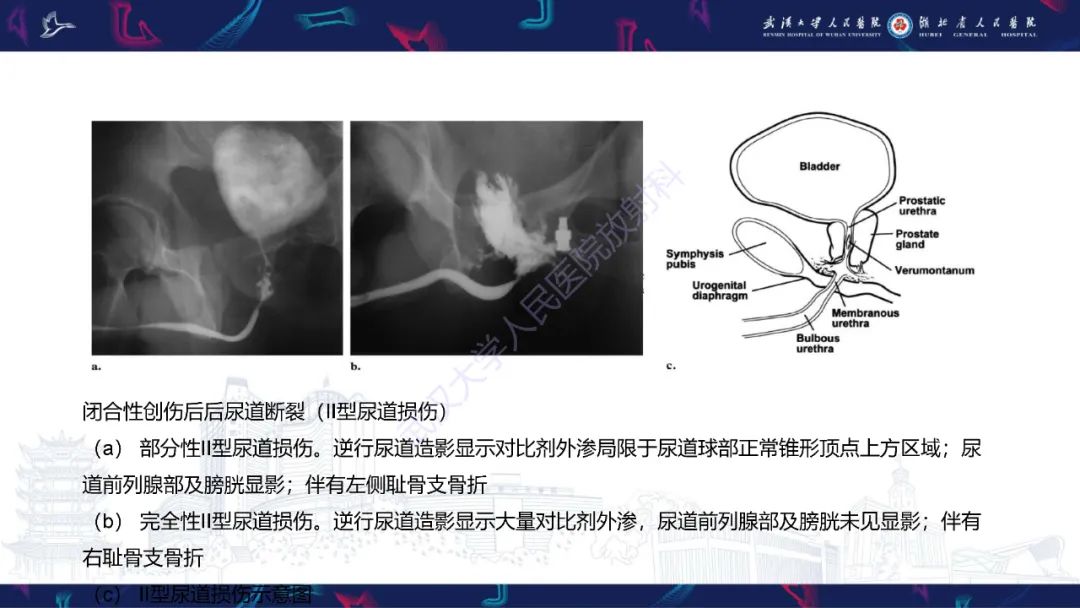 【PPT】尿道造影疾病诊断-21