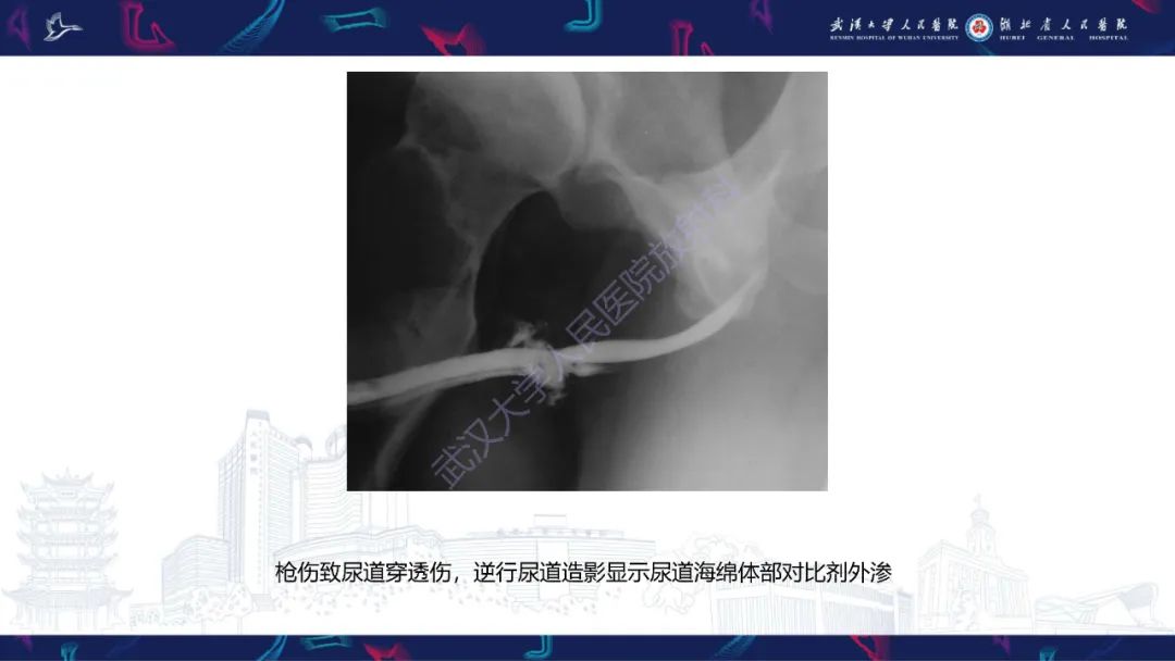 【PPT】尿道造影疾病诊断-34